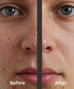 Nixoderm Antibacterial Soap