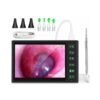 Digital Otoscope with 7-Inch IPS Screen & 3.9mm Ear Camera