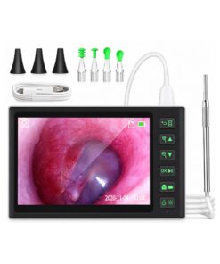 Digital Otoscope with 7-Inch IPS Screen & 3.9mm Ear Camera