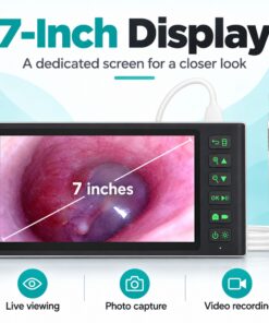 Digital Otoscope with 7-Inch IPS Screen & 3.9mm Ear Camera